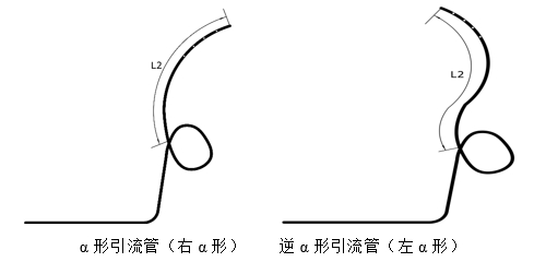 經鼻膽汁外引流管注冊審查指導原則（2022年第41號）(圖13)