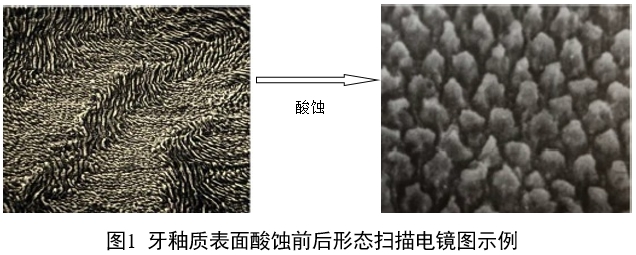 牙科用磷酸酸蝕劑注冊(cè)審查指導(dǎo)原則（2022年第41號(hào)）(圖1)