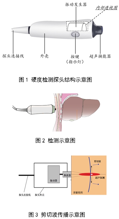 定量剪切波超聲肝臟測(cè)量?jī)x注冊(cè)審查指導(dǎo)原則（2023年第7號(hào)）(圖2)