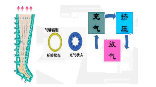 肢體加壓理療設備注冊技術審查指導原則（2019年第79號）(圖9)